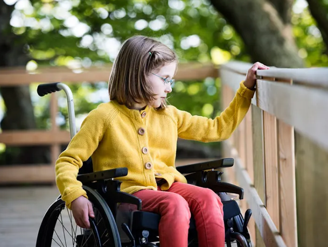A child with ataxia telangiectasia. Source: Acute Cerebellar Ataxia: ClarklandCompany